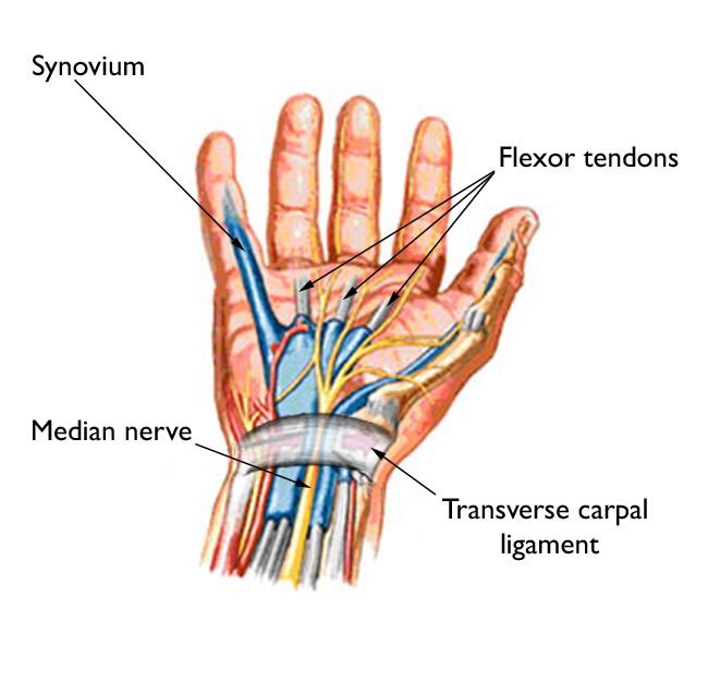 Understanding Carpal Tunnel Syndrome with Dr Sathya Vamsi Krishna