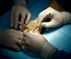 Microsurgery