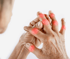 Hand Pain and Arthritis